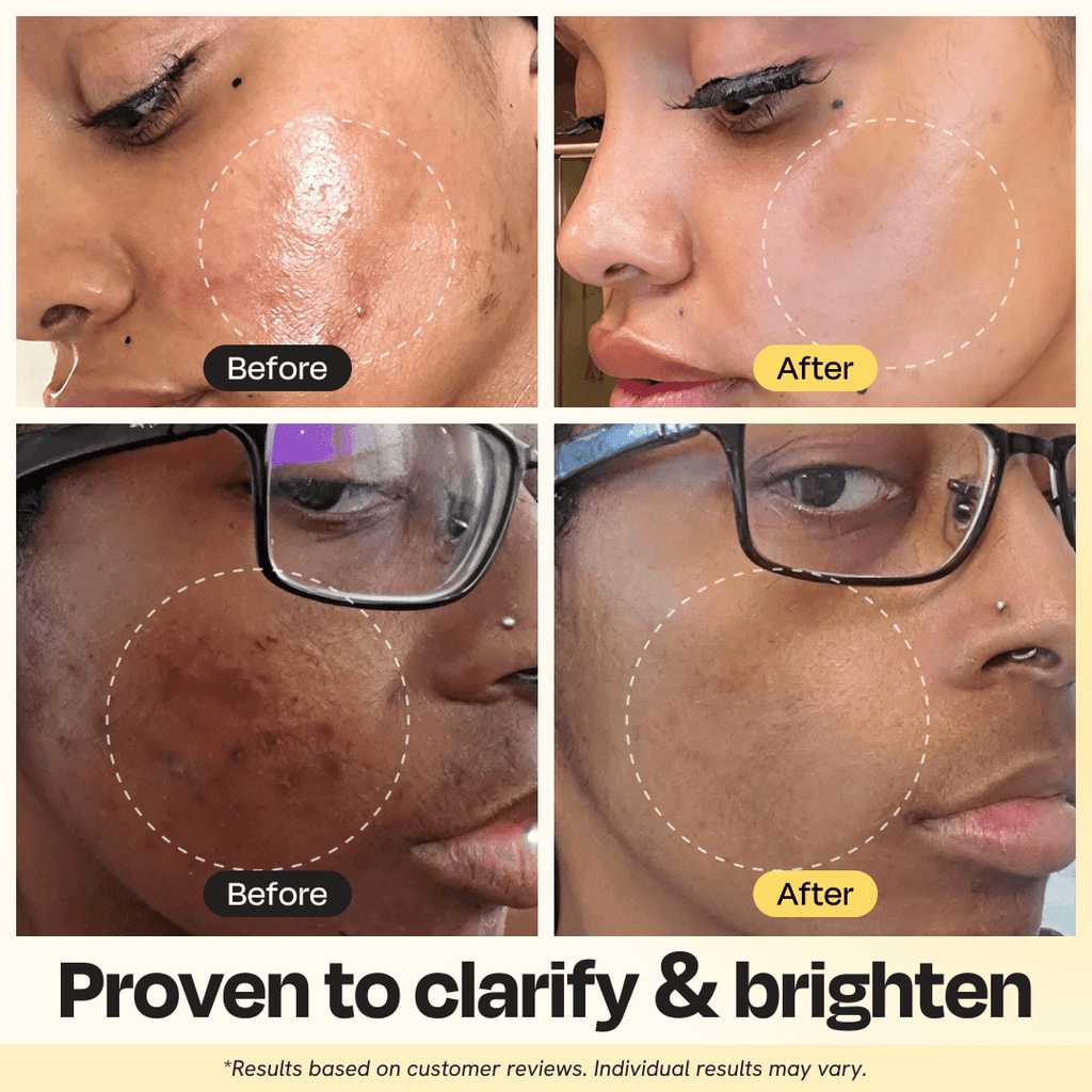 Vitamin C Clay Mask - PureNaturalRadiance.com