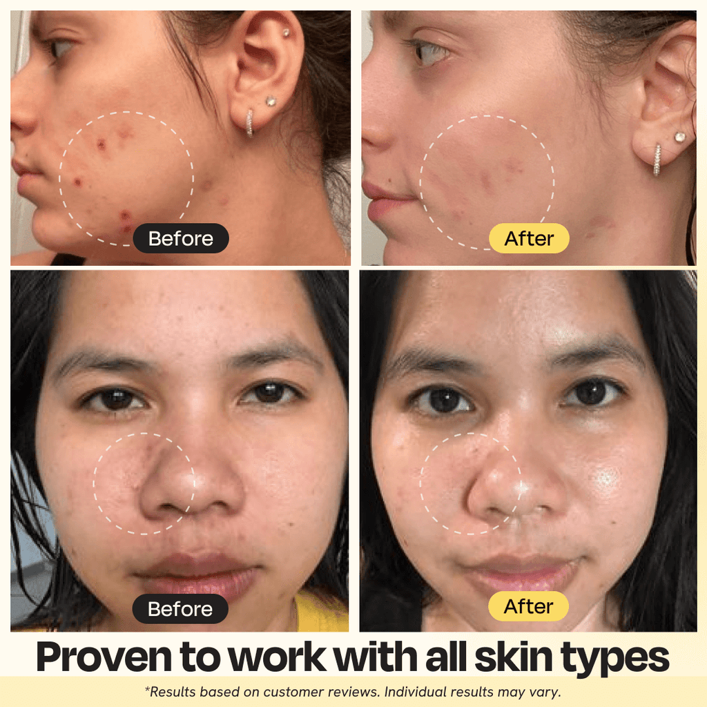 Vitamin C Clay Mask - PureNaturalRadiance.com