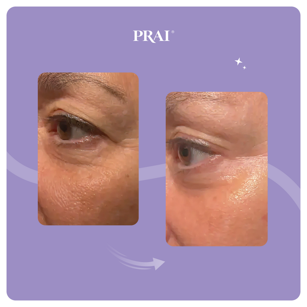 Ageless Eye Tight Uplift Serum - PureNaturalRadiance.com